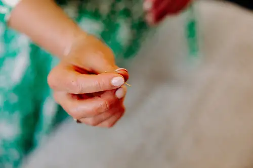 Click Here To Enlarge This Photo Of Can Acupuncture Help Fertility in Those Who Have Endometriosis?